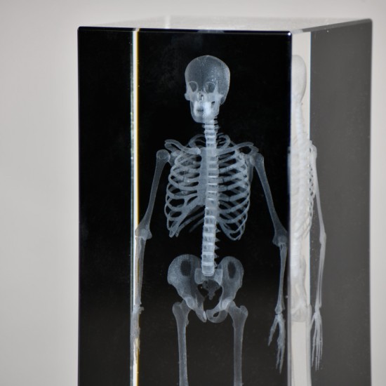 Radiographie 3D de...